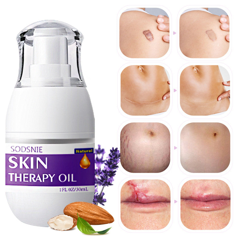 Skin Treatment Oil Remove Puncture Cellulite Stretch Mark Repair Body Care 30ml - More bang for your bucks