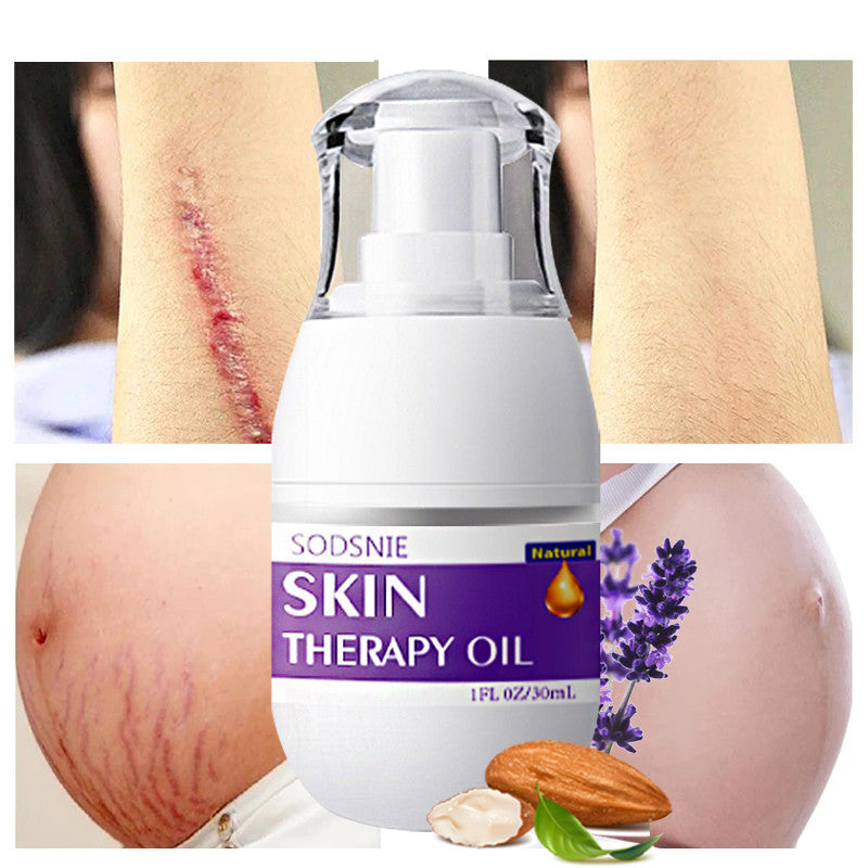 Skin Treatment Oil Remove Puncture Cellulite Stretch Mark Repair Body Care 30ml - More bang for your bucks